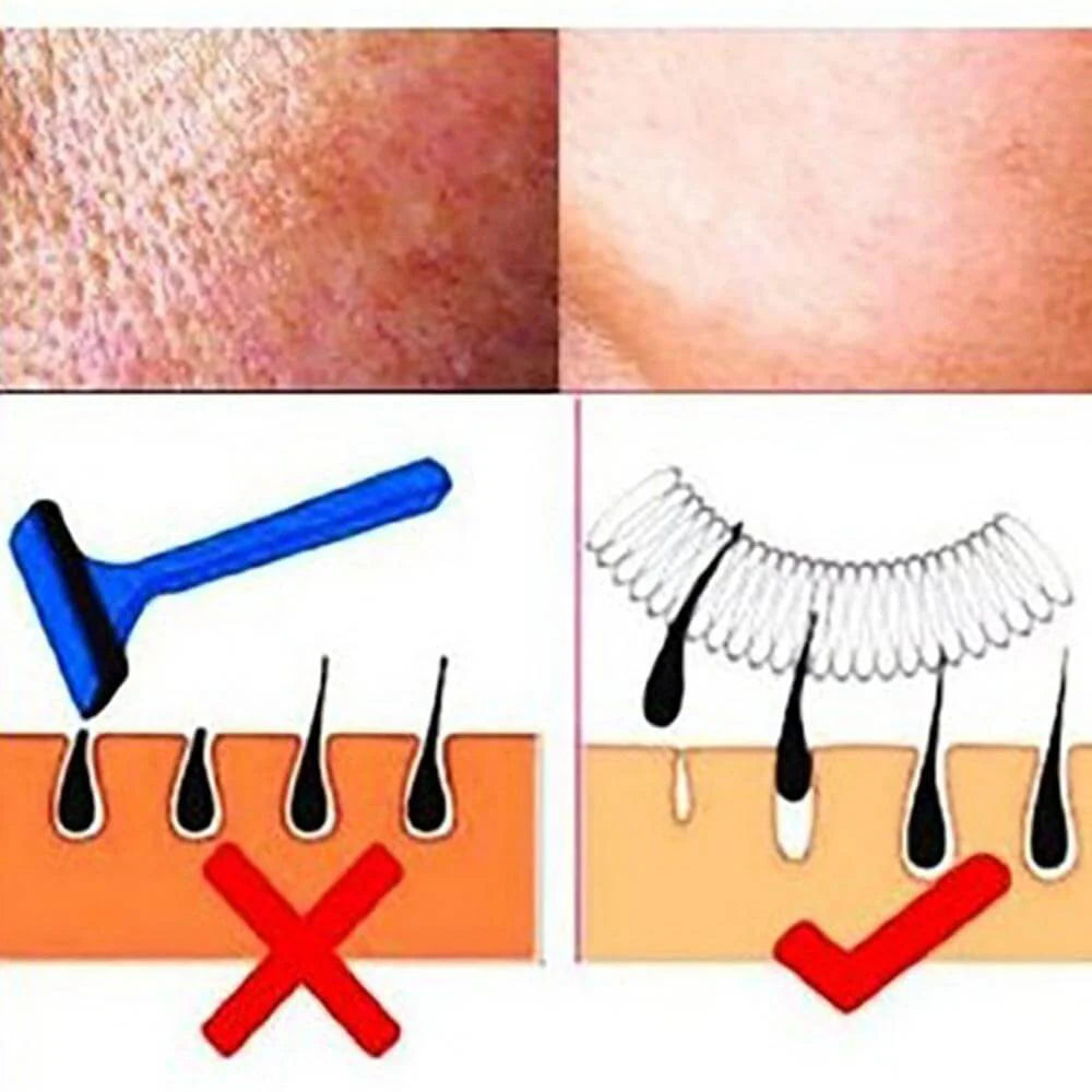 Facial Hair Remover D8887